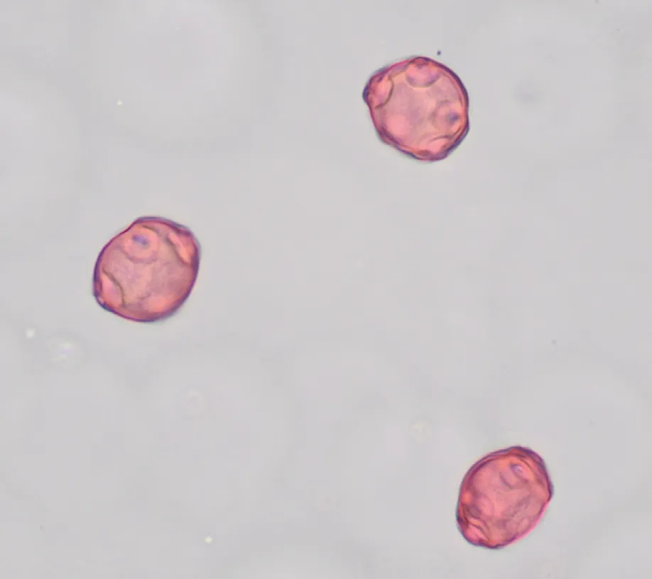 Figure 5: Alder pollen.